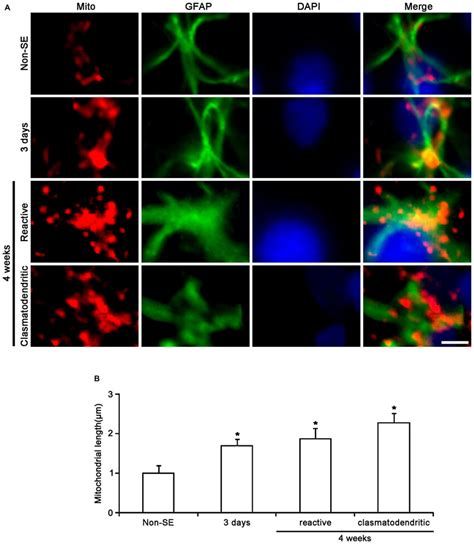 Change In Mitochondrial Morphology In Astrocytes Within The CA1