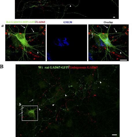 Human Gad Gfp Is Targeted To Golgi Membranes Cytosolic Vesicles And