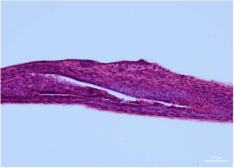 Extrahepatic Bile Duct And Gall Bladder Dissection In Nine Day Old