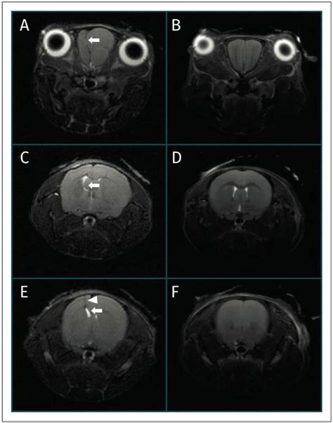 Sequential T2 Weighted T2w Transverse Magnetic Resonance Images