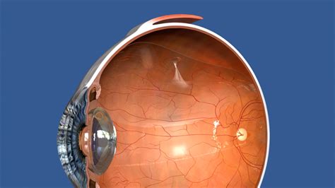 Retina Detachment Treatment Kam Balaggan Retinal Surgeon