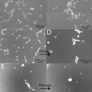 Morphological Appearance Of Undifferentiated And Differentiated SH SY5Y