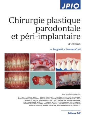 Livre Chirurgie Plastique Parodontale Et Peri Implantaire CDP JPIO A