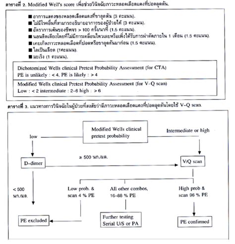 ภาวะหลอดเลอดขาและปอดอดตน deep vein thrombosis and pulmonary