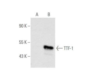 Anti TTF 1 Thyroid Transcription Factor 1 NKX2 1 Antibody F 12 SCBT