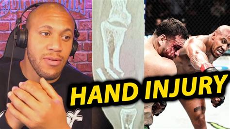 Ciryl Gane On Broken Hand In Tai Tuivasa Fight Youtube