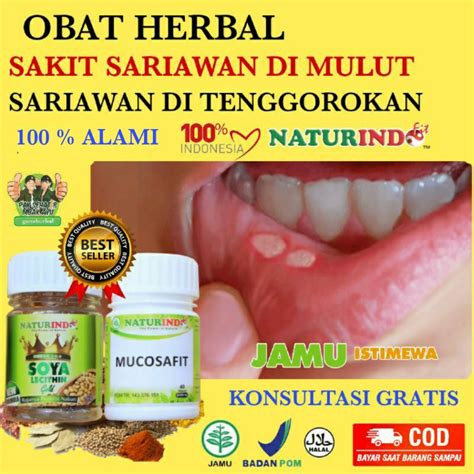 Jual Obat Sariawan Di Mulut Anak Obat Herbal Sakit Sariawan Sakit