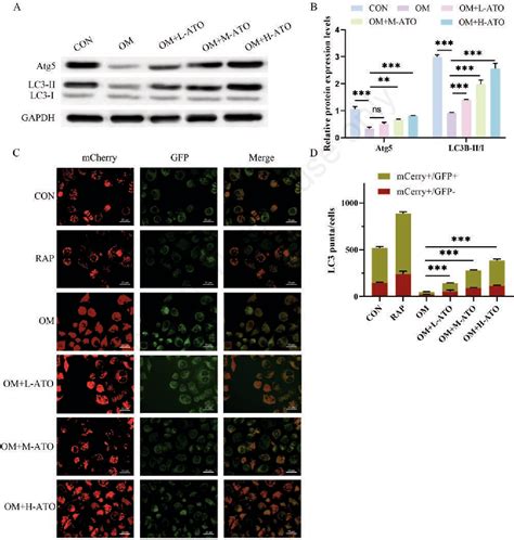 Figure From Atorvastatin Reduces Calcification In Valve Interstitial