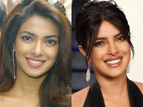 Priyanka Chopra Before After Pics Transformation Tuesday Priyanka