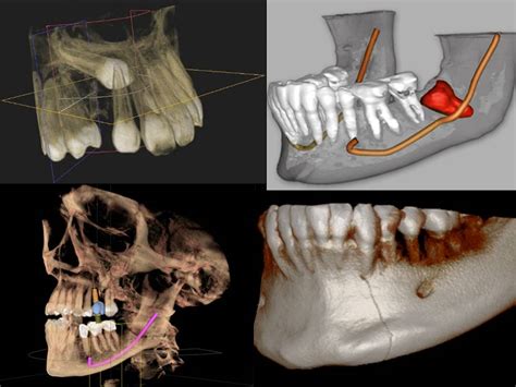 Technology Spotlight The Dental Cone Beam CT Gateway Oaks Dental