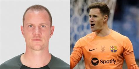 Marc Andr Ter Stegen Hair Transplant Everything You Need To Know