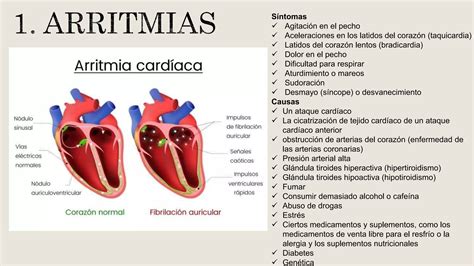 Enfermedades Del Sistema Digestivo Por Patricia Lalangui Ppt