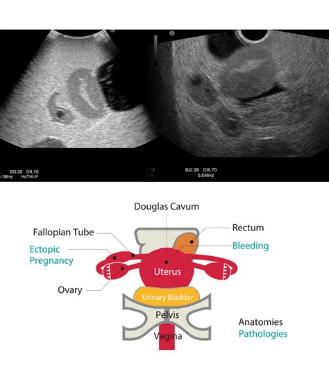 Obstetric Pelvic Ultrasound Phantom (2 units/7W) (US-10D) – Imaging