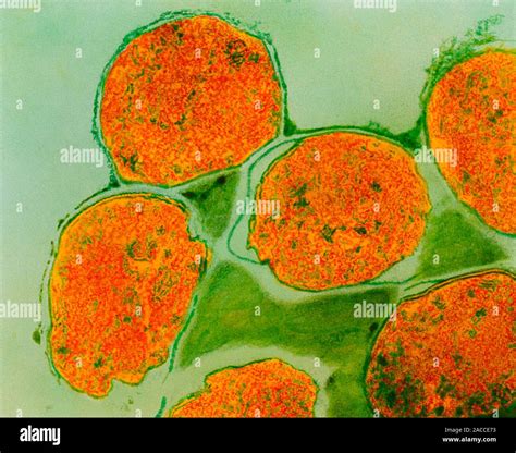 Mycobacterium Leprae Transmission Electron Micrograph Of A Section Through A Group Of