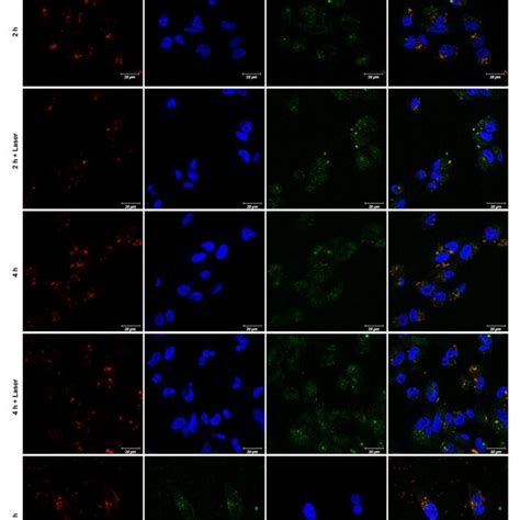 Cell Uptake And Lysosomal Escape Of Au Msn‐ptx Cpt Polymer Nps Flow Download Scientific