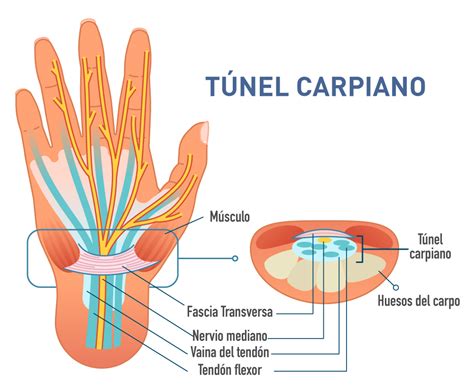 Síndrome del túnel carpiano Policlínico San Miguel