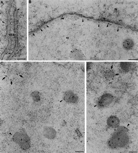 Immunoelectron Microscopy Localization Of The 21 To 23 KDa Protein In