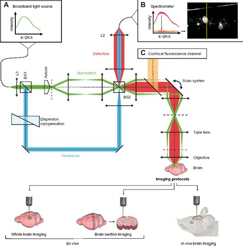 PDF Label Free Imaging of Cerebral β Amyloidosis with Extended Focus