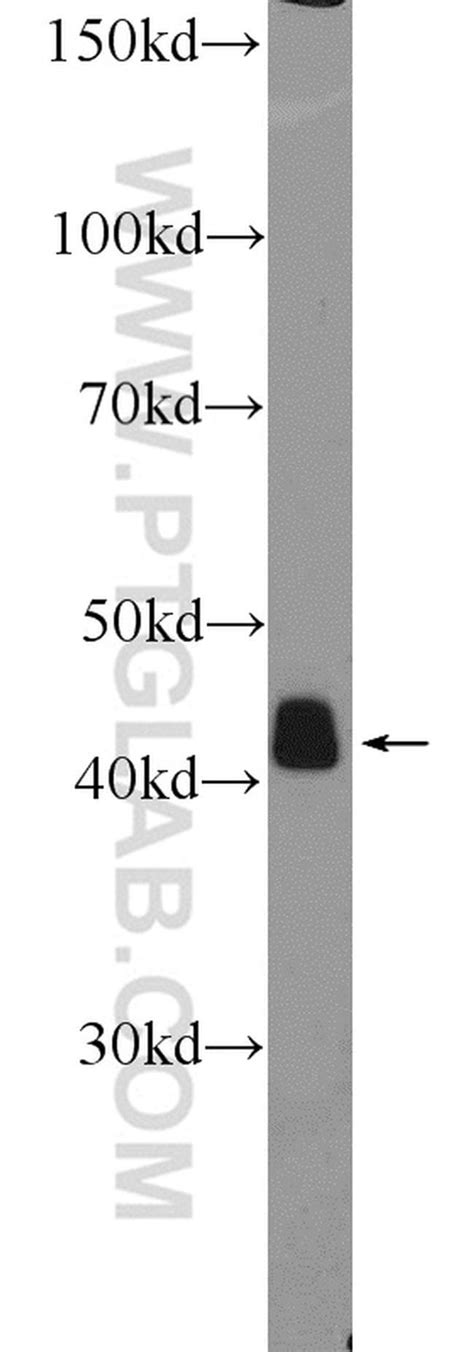 Alpha Sma Rabbit Anti Human Mouse Rat Polyclonal Proteintech L