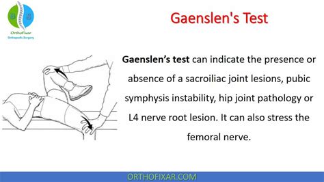 Gaenslens Test Orthofixar 2025