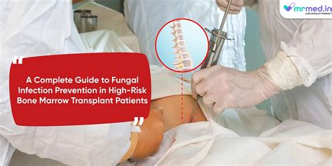 A Complete Guide to Fungal Infection Prevention in High-Risk Bone Marrow Transplant Patients ...