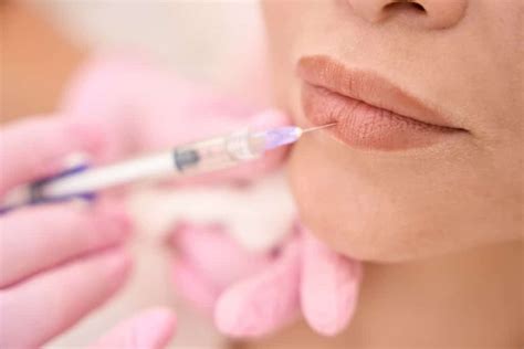 Lip Fillers 101 What To Expect During Your First Appointment Botox