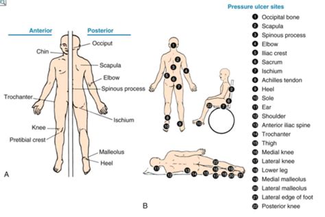 Wounds And Wound Care Flashcards Quizlet