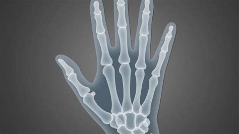 MYTH BUSTER: Is Knuckle Cracking Bad For You? | Piedmont Healthcare