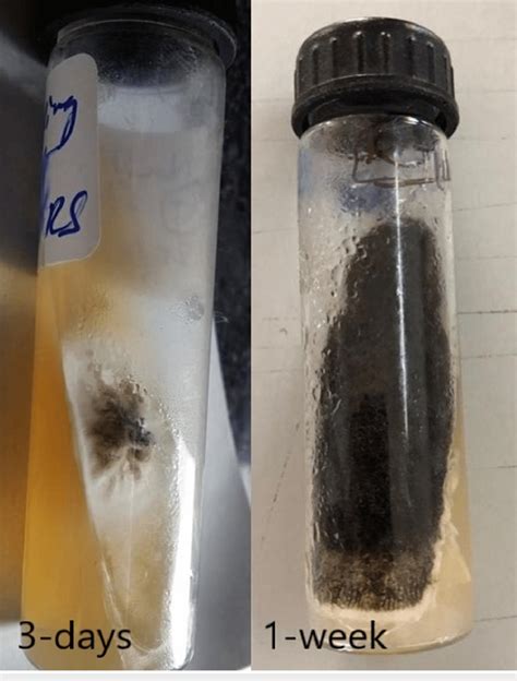 The Sabouraud Dextrose Agar Culture Incubated At Room Temperature Shows