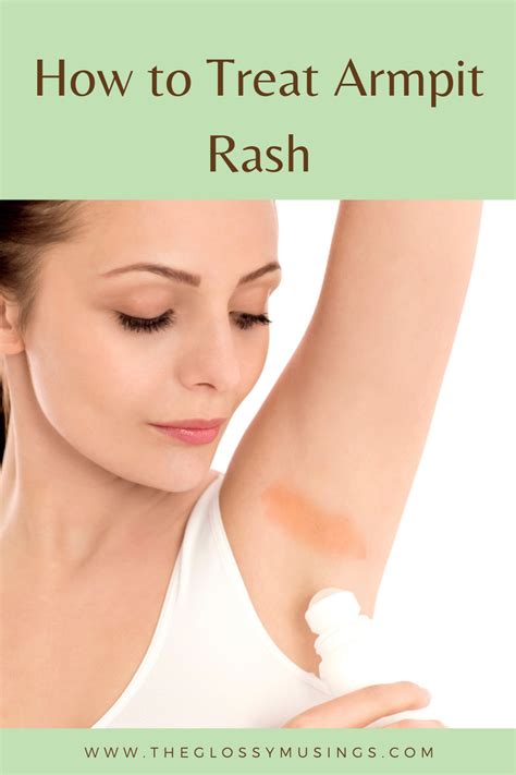 How To Get Rid Of Armpit Rash Armpit Rash Underarm Rash Types Of Rashes