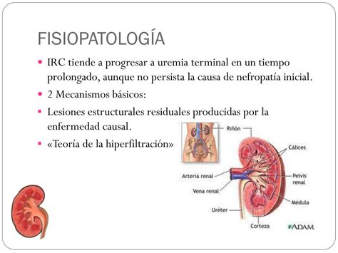 Ppt Insuficiencia Renal Cr Nica Powerpoint Presentation Free