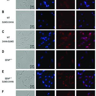 Subcellular Localisation Of Ha Tagged Sumo Wild Type Wt A Or L