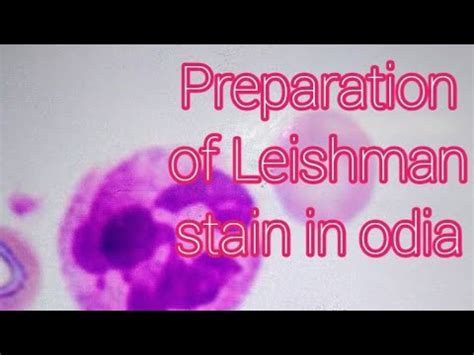 Preparation Of A Leishman Stain Youtube