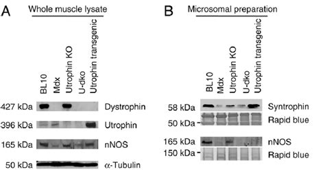 Western Blot Analysis Of Nnos Expression In Whole Muscle Lysate And