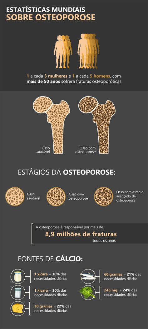 Osteoporose Causas Sintomas E Tratamentos Formularium