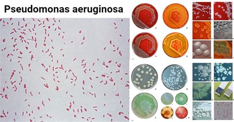 Şase etern Ce drăguț microscopie gram pseudomonas aeruginosa Reporter Disciplina Predica