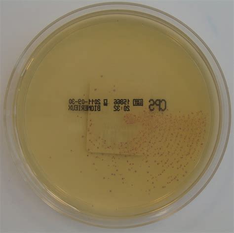 Streptococcus Pyogenes Group A Streptococcus On Chromid Flickr