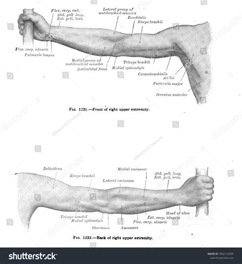 upper extremity   royalty  licensable stock