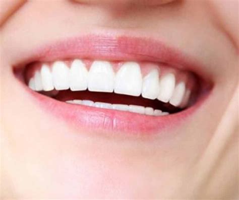 Gum Disease Treatment Melbourne Dentist Melbourne Gentle Dentists