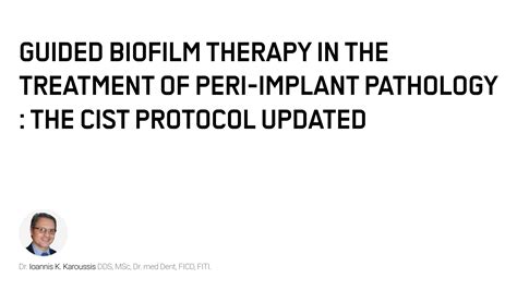 Guided Biofilm Therapy In The Treatment Of Peri Implant Pathology The