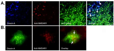 representative photomicrographs  triple label  staining  nmdar
