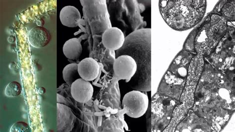 Chytridiomycota BiologÍa Y GeologÍa