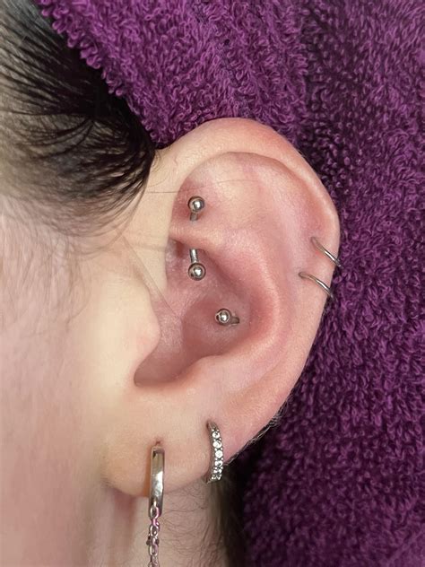 Does My Conch Look Like It’s Developing A Keloid Almost 7 Months Old R Piercing