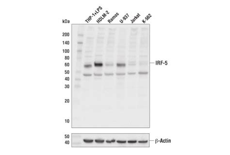 IRF-5 (E1N9G) Rabbit mAb | Cell Signaling Technology