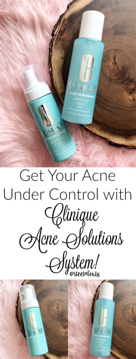 Get Your Acne Under Control with Clinique Acne Solutions System!