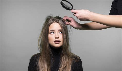 8 Ways To Use Baking Soda For Getting Rid Of Dandruff