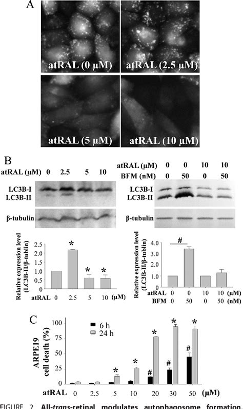 Figure From Autophagy Protects The Retina From Light Induced