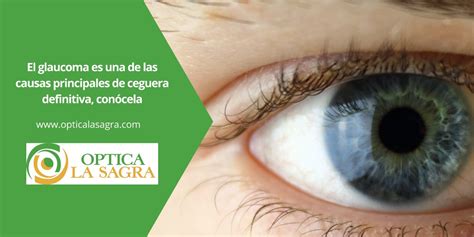 El Glaucoma Es Una De Las Causas Principales De Ceguera Definitiva