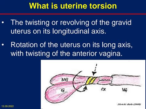 Solution 10 Bovine Uterine Torsion Studypool