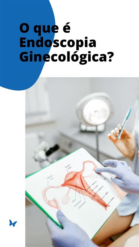 Endoscopia Ginecol Gica Em Endoscopia Tratamento Sa De Da Mulher